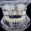 14K Gold Plated Diamond-Cut Top Teeth Grillz