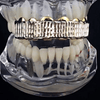 14K Gold Plated Diamond-Cut Top Teeth Grillz