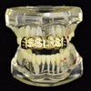 14K Gold Plated Dollar Signs Top Teeth Grillz