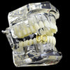 14k Gold Plated Double Bottom Right Vampire Fang Single Tooth Cap