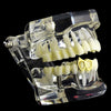 14k Gold Plated Double Bottom Right Vampire Fang Single Tooth Cap