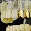 14K Gold Plated Double Caps - Left Hand Teeth