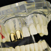 14K Gold Plated Double Caps - Right Hand Teeth