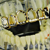 14K Gold Plated Four Open Teeth Diamond-Cut Two-Tone Top Grillz