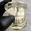 14K Gold Plated Gap Grill Pink CZ Iced Single Tooth Grillz