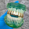 14k Gold Plated Grillz Deeper-Cut Top 8 Eight Teeth