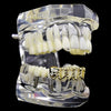 14K Gold Plated Grillz Four Open Face Diamond-Cut 4 Windows Bottom Teeth