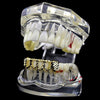 14K Gold Plated Grillz Four Open Face Diamond-Cut 4 Windows Bottom Teeth