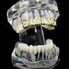 14K Gold Plated Grillz Four Open Face Diamond-Cut Top Teeth 4 Windows