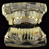 14K Gold Plated Iced Cluster Top Teeth Grillz