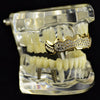14K Gold Plated Iced Cluster Top Teeth Grillz