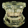 14K Gold Plated Iced Crown Top Teeth Grillz