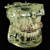 14K Gold Plated Iced Crown Top Teeth Grillz