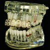 14K Gold Plated Iced Crown Top Teeth Grillz