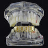 14K Gold Plated Iced CZ Four Open Face Bottom Teeth Grillz