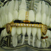 14K Gold Plated Iced CZ Gap & Bar Teeth Grillz Set