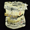 14K Gold Plated Iced CZ Six Open Face Top Teeth Grillz