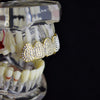14K Gold Plated Iced Micro Pave Top Teeth Grillz
