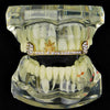 14K Gold Plated Marijuana Weed Leaf Top Teeth Iced Bar Grillz
