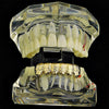 14k Gold Plated Nugget Bottom Teeth Grillz