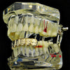 14k Gold Plated Nugget Bottom Teeth Grillz