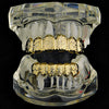 14K Gold Plated Nugget Teeth Grillz Set