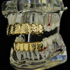 14K Gold Plated Nugget Teeth Grillz Set