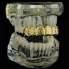 14K Gold Plated Nugget Top Teeth Grillz