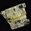 14K Gold Plated Number #23 Iced Top Double Cap Tooth Grillz