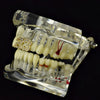 14K Gold Plated Number #23 Iced Top Double Cap Tooth Grillz