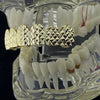 14k Gold Plated On 925 Silver Top Diamond-Cut Grillz