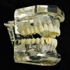 14K Gold Plated Open Single Cap Bottom Tooth