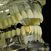 14K Gold Plated Open Single Cap Bottom Tooth