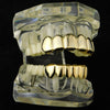 14k Gold Plated over 925 Sterling Silver 6/6 Grillz Set