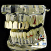 14K Gold Plated over 925 Sterling Silver Top Teeth Grillz