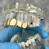 14K Gold Plated Permanent Cut Perm Cuts Top Teeth Pre-Made Grillz