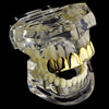 14K Gold Plated Plain Top Teeth Grillz