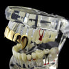 14k Gold Plated Plain Top Teeth Vampire Fangs Grillz