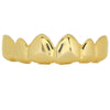 14K Gold Plated Pointy Top Grillz