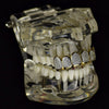 14K Gold Plated Premium CZ Iced Two -Tone Top Teeth Micro Pave Grillz