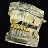 14K Gold Plated Six Open Face Hollow Bottom Teeth Grillz