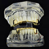 14k Gold Plated Slim Bar Grillz Top & Bottom Teeth Set