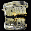 14k Gold Plated Slim Bar Grillz Top & Bottom Teeth Set