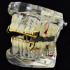 14k Gold Plated Slim Bar Grillz Top & Bottom Teeth Set