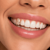 14k Gold Plated Star Open Face Canine Cap One Tooth Single Grillz