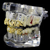 14K Gold Plated Thug Life Teeth Top & Bottom Grillz Set