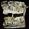 14K Gold Plated Two-Row Side Bling Iced Bottom Grillz