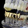 14K Gold Plated Vampire Fangs Bottom Teeth Grillz