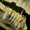 14K Gold Plated Vertical Bars Bottom Teeth Grillz