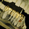 14K Gold Plated Vertical Bars Bottom Teeth Grillz